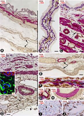 Presence/Absence and Specific Location of Resident CD34+ Stromal Cells/Telocytes Condition Stromal Cell Development in Repair and Tumors